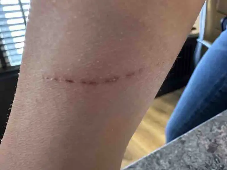 Petroleum jelly for wound healing